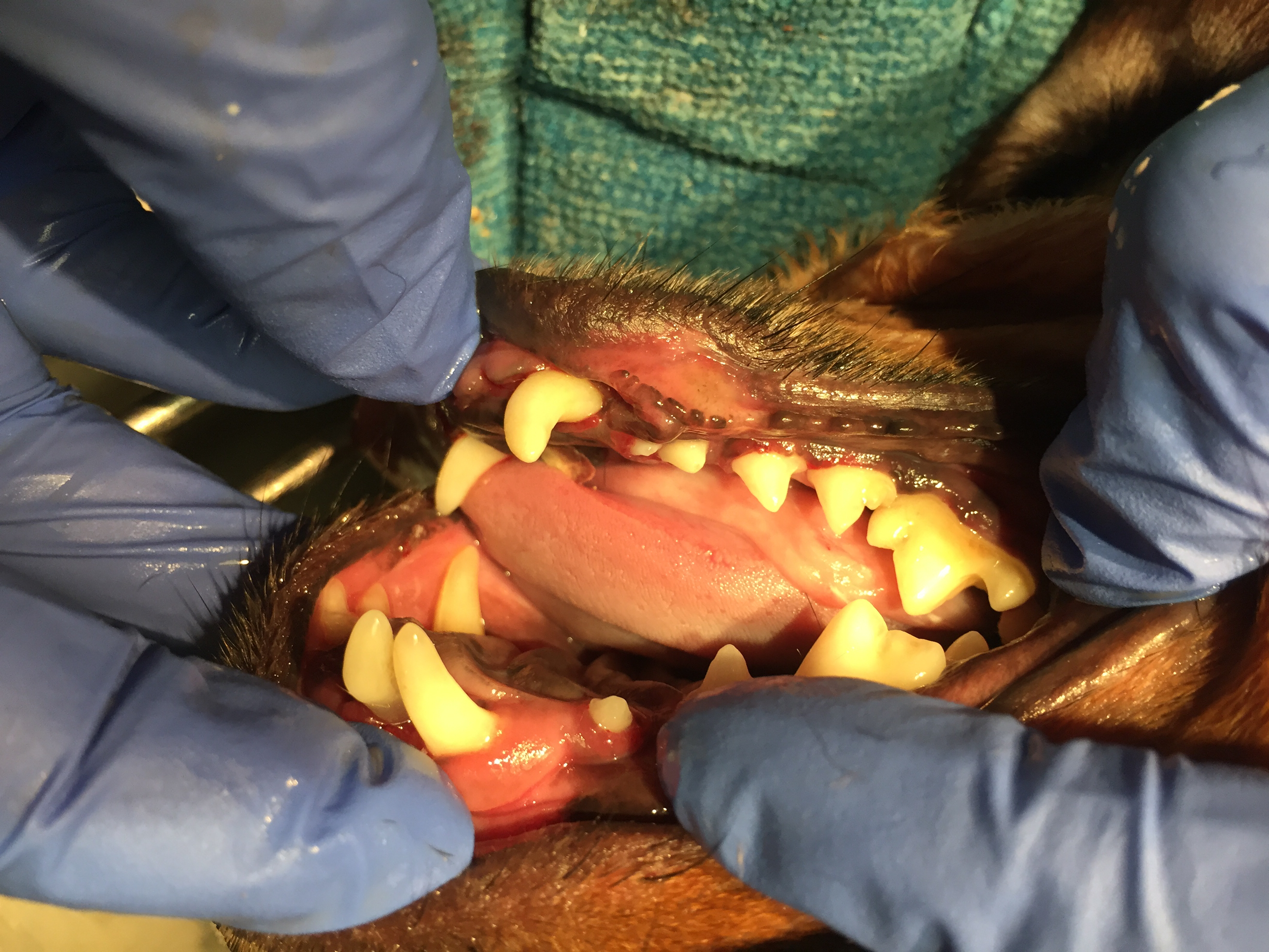 periodontal disease